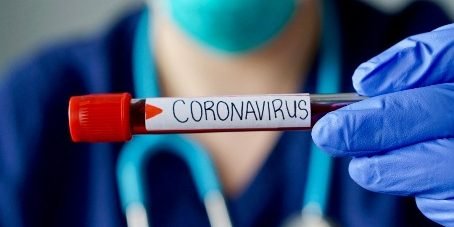 coronavirus-provetta-rossa-portale